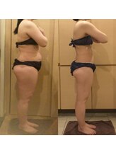 アユアランリンク 札幌中島公園店/Ｇ様：側面