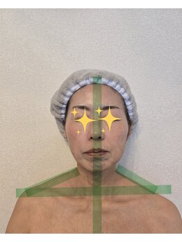 バンブー(Bamboo)/肩こりさんも肩下がり首長効果