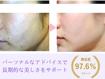 アイリス(IRIS)の写真