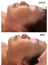 エ アラ エ(E.ala.e)/最強小顔レモンボトル