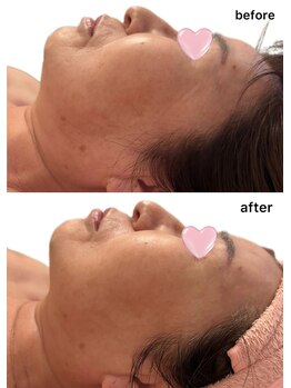 エ アラ エ(E.ala.e)/最強小顔レモンボトル