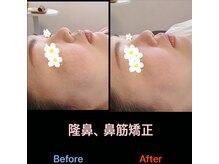 美容矯正サロン レレポノ(LELEPONO)/