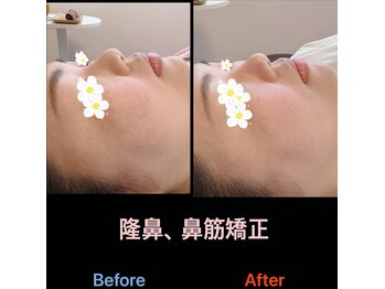 美容矯正サロン レレポノ(LELEPONO)/