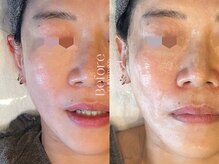 キュレイテッドスキン(CURATED SKIN)の雰囲気(最新ピーリングで叶う憧れの艶肌。栄養導入で肌トラブルも解消◎)