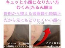 メディカモン(medikamon)