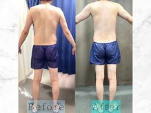 パラディ(PARADIS)/ハイパーナイフ/シェイプ/コルギ