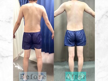 パラディ(PARADIS)/ハイパーナイフ/シェイプ/コルギ