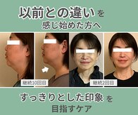 ベルソー(Berceau)