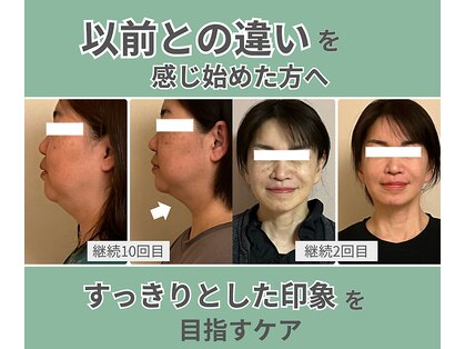 ベルソー(Berceau)の写真