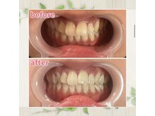 パルティービューティー 天満店(PARTIE BEAUTY)/お客様の変化をお届け【No.9】