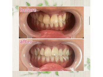 パルティービューティー 天満店(PARTIE BEAUTY)/お客様の変化をお届け【No.9】