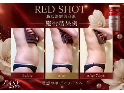 イージー(EASY)の写真