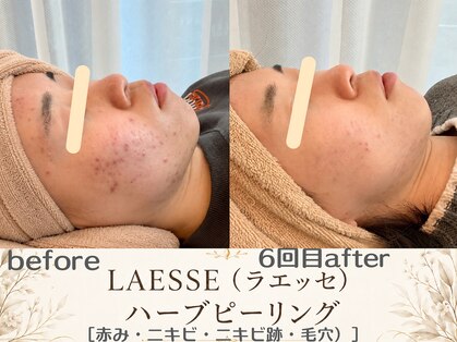エスポワール(espoir)の写真