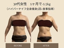 オベリオ(OBERIO)/ハイパーナイフ全身痩身