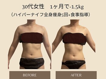 オベリオ(OBERIO)/ハイパーナイフ全身痩身