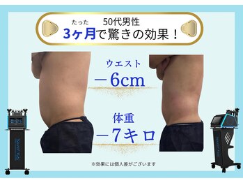 ベルフィーヌボーテ(BELFINE beaute)/痩身エステ90分