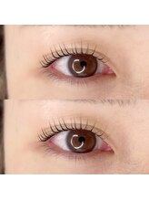 エラ(ELLA)/ラッシュリフト上