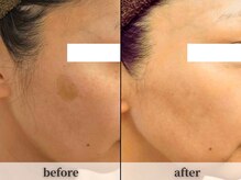 ワールドビューティー(World Beauty)の雰囲気（【ADS肌改善プログラム3ヶ月】 シミ改善症例多数あります。）