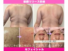 CBDサロン ローズ(ROSE)