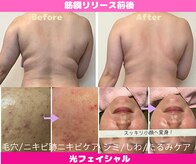 CBDサロン ローズ(ROSE)