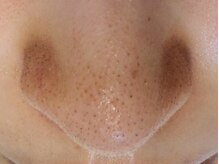 サロンドール(Salon doll)