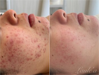 プライベートサロン ラウレア(Laule'a)/HAABREPRO