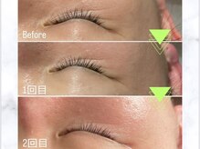 イードットアイブロウサロン(E.eyebrow salon)/ラミネーションピール