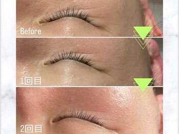 イードットアイブロウサロン(E.eyebrow salon)/ラミネーションピール