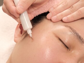 ビシル(Bishiru.)の写真/【最新エイジングケア】シミケア専門マシンでハリ/弾力UP×小顔を実現!!蓄積した紫外線ダメージを徹底ケア*