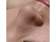オンド(OND)の写真/ダクトピール/毛穴洗浄/プラズマなどの技術を組み合わせ肌状態に合わせた低刺激な毛穴ケアをご提案します。
