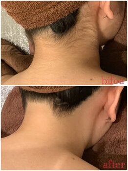 シースタイル(C-S.t.y.l.e.)/うなじ脱毛♪