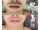 ソロリ(sorori)の写真