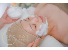 シェノン(chainon)/小顔になりたい花嫁さまへ