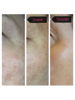 メディカルサンテロッソ 福岡店(MEDICAL SANTEROSSO)/★おすすめクーポン★