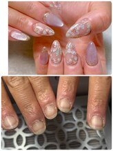 ネイルユー(Nail Yu)/長さだし10本定額コース