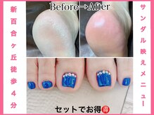 ネイルエイト 新百合ヶ丘(nail8)/セット割得サンダル映えメニュー