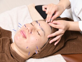 アキュリス(aquliss)の写真/美容鍼×高保湿美容液導入で肌質改善！自律神経が整い、心身ともにリラックスできる特別な時間をご提供♪
