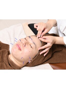 ハリツヤをUPしたい