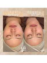 ウリ(uli beauty)/比較写真