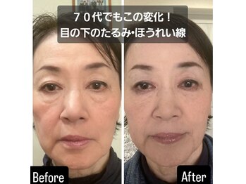 ラカン ビューティーアンドスキン(Lacan beauty&skin)