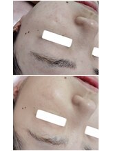 ビーユー(Be.you)/ツヤ肌