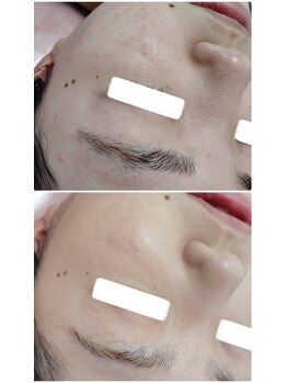 ビーユー(Be.you)/ツヤ肌