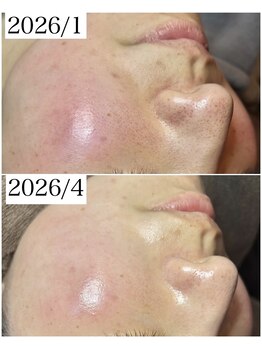 ブラックボックス(BLACK BOX)/20代女性のお客様