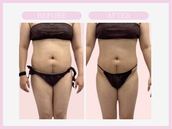 スリムライン 盛岡店(The Slim Line)/before→after