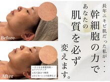 アンフィア(Anfia)の雰囲気（【肌質管理】ハーブピーリング×ヒト幹細胞◇確実ツル肌になれる）