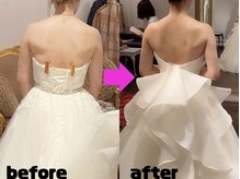 柚香鍼灸院/美姿勢矯正　効果