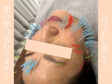 健志接骨院/お肌のお悩み全般への対応