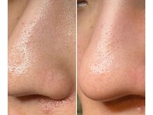 サイ(Sai)/成人式に向けて