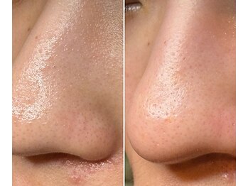 サイ(Sai)/成人式に向けて