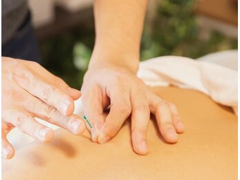 みき鍼灸マッサージの写真/「鍼灸は初めて」という方にこそ試してほしい！腰の重だるさをスッキリ解消して身軽な毎日へ導きます☆